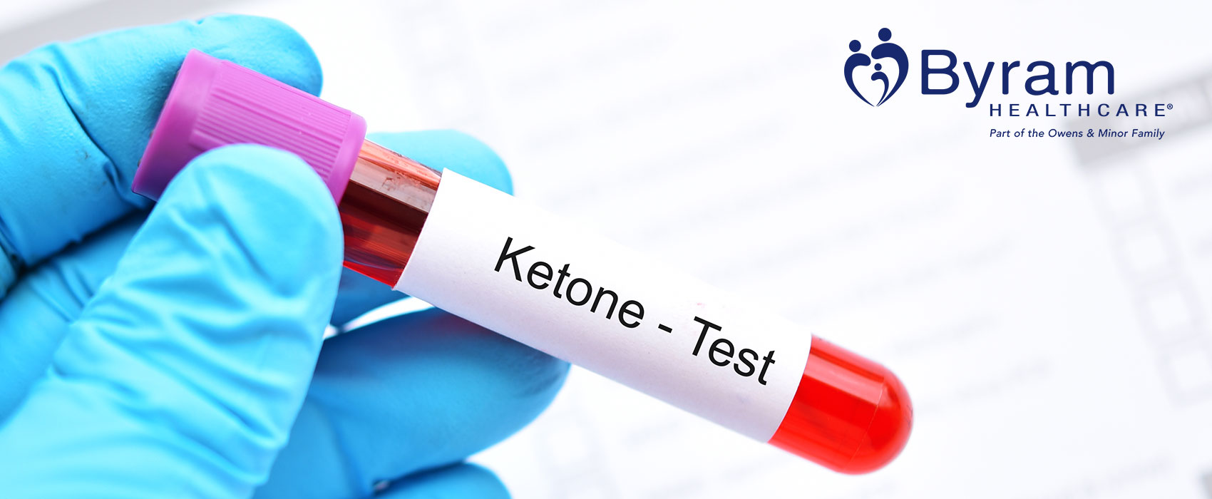 Ketones in Urine: Causes, Symptoms, Tests and What it Means